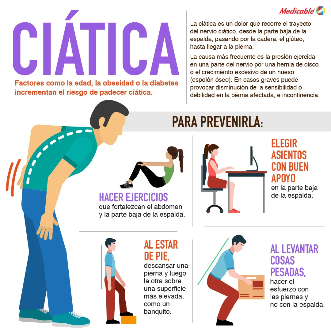 Ciática 
