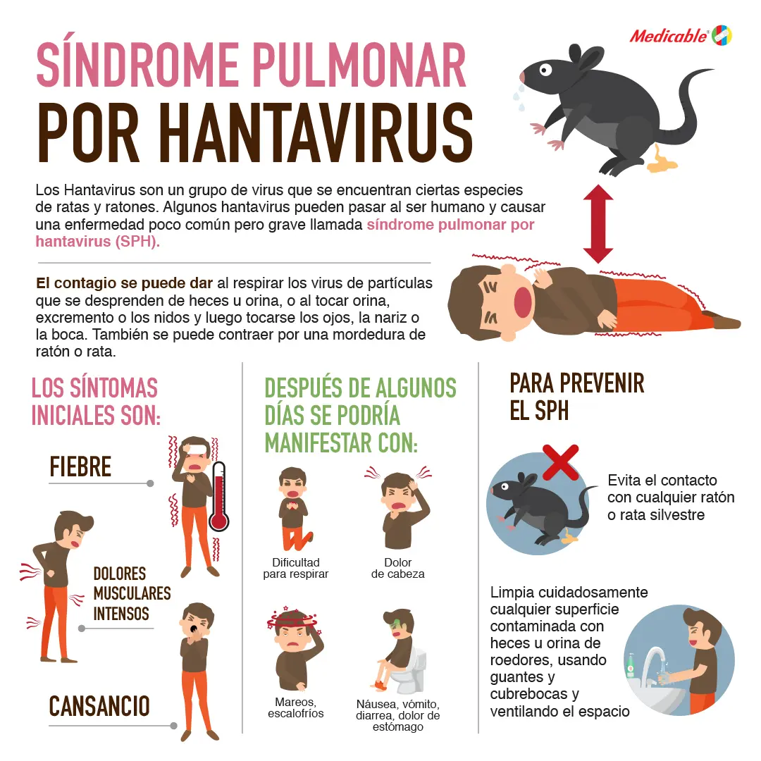 Síndrome pulmonar por Hantavirus