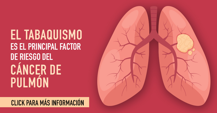 Cáncer de pulmón