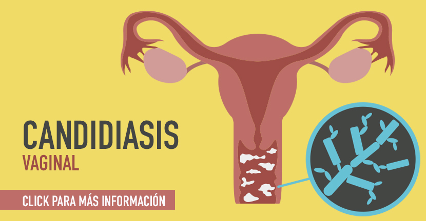 Candidiasis vaginal