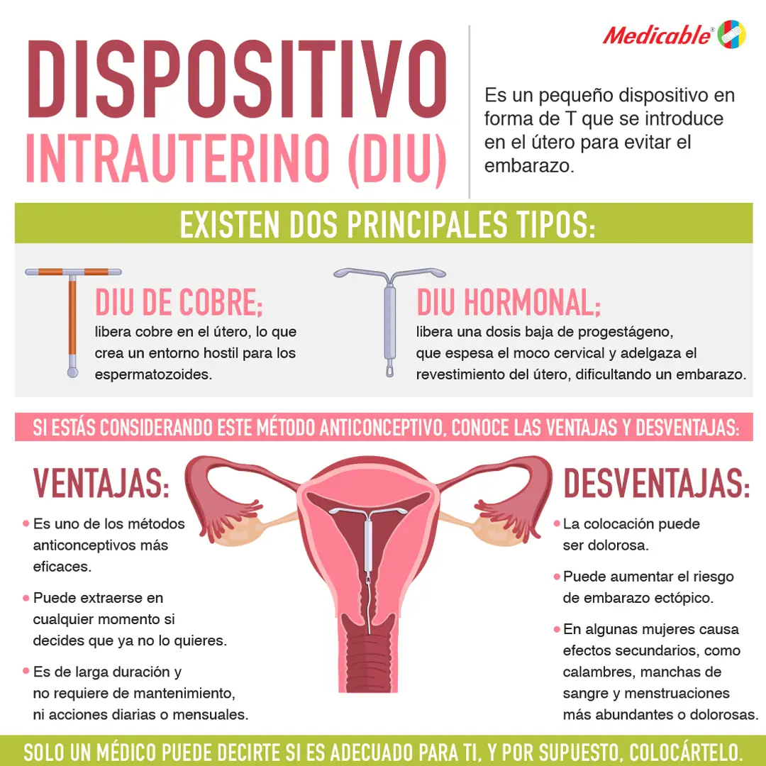 Dispositivo intrauterino (DIU)
