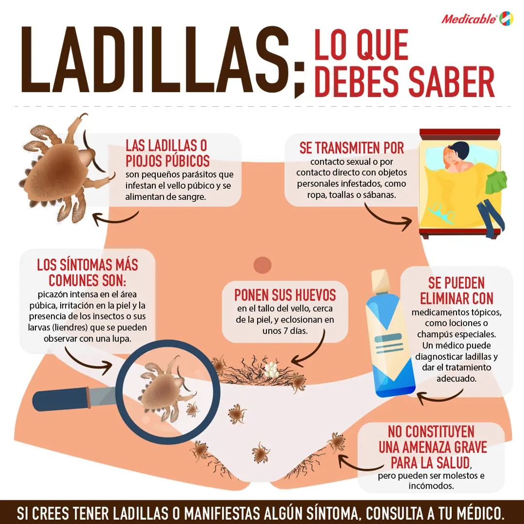 Ladillas; lo que debes saber