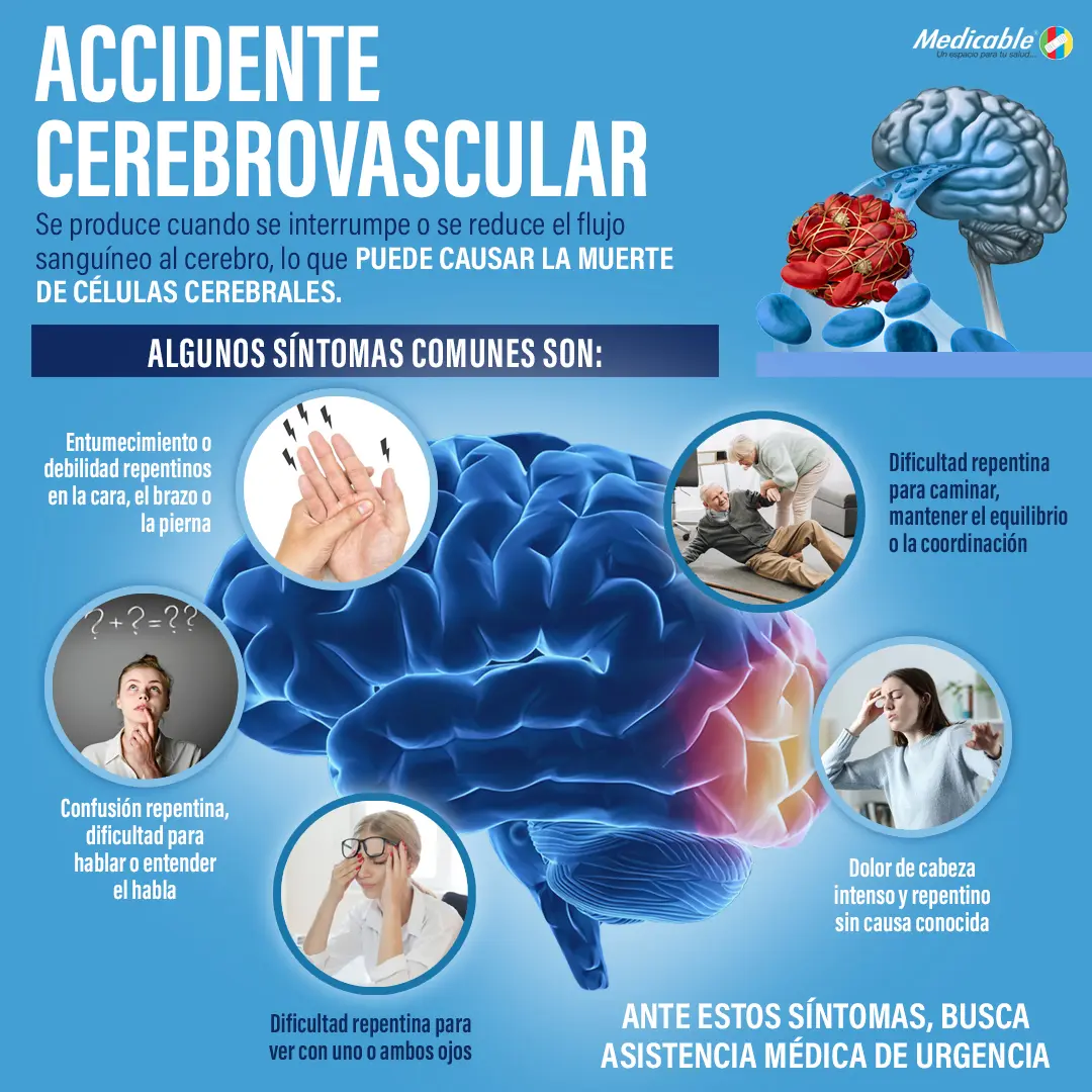 Accidente cerebrovascular