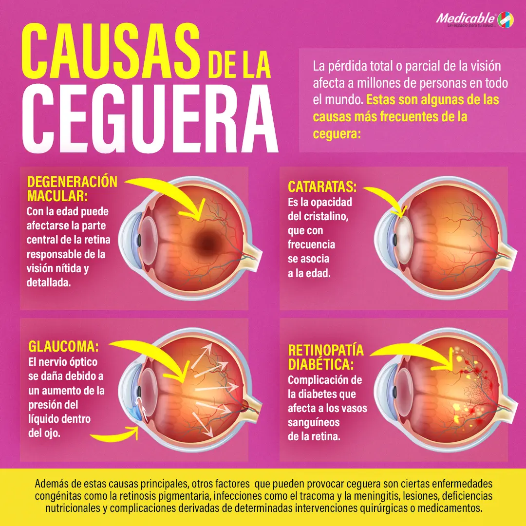 Causas de la ceguera