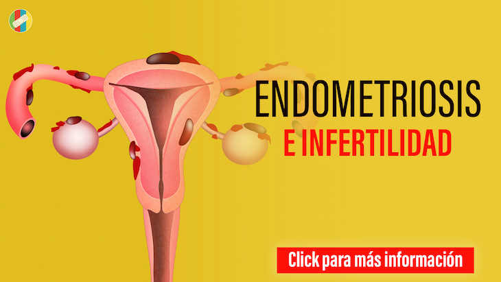 Endometriosis e infertilidad