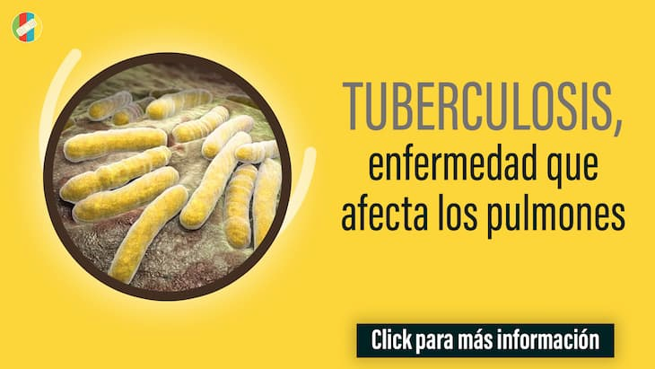 Tuberculosis, enfermedad que afecta los pulmones
