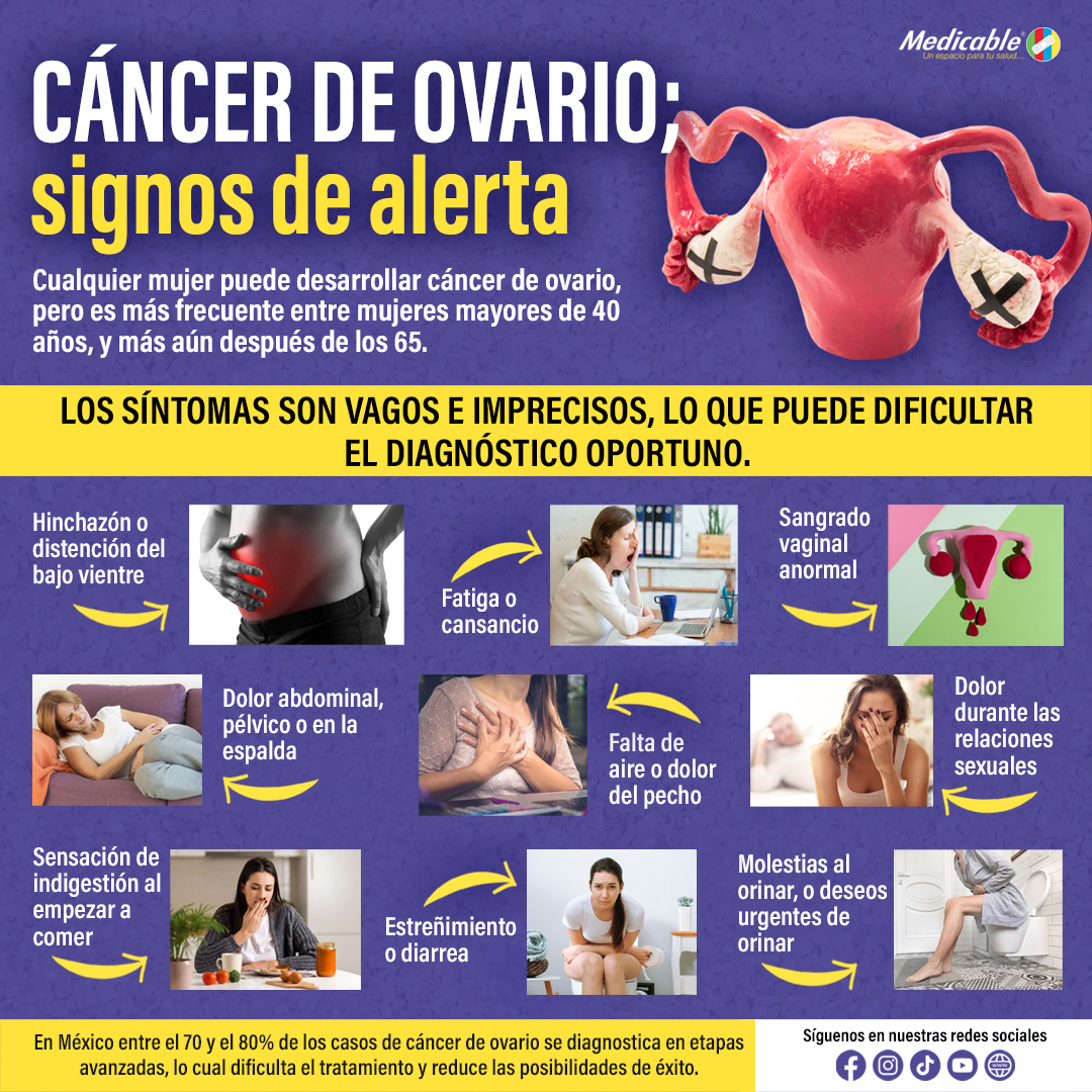 Cáncer de ovario.