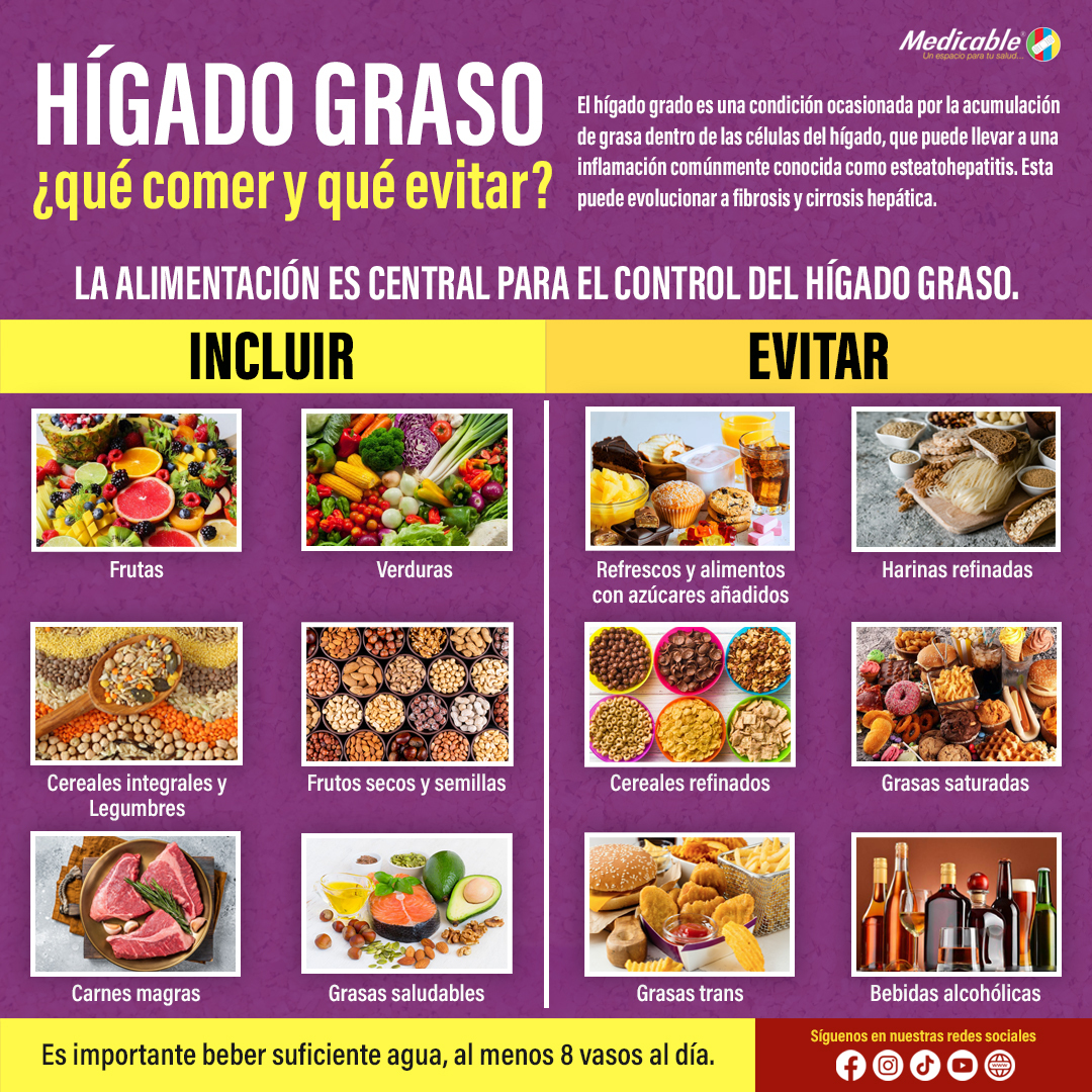 Hígado graso, ¿Qué comer y qué evitar?