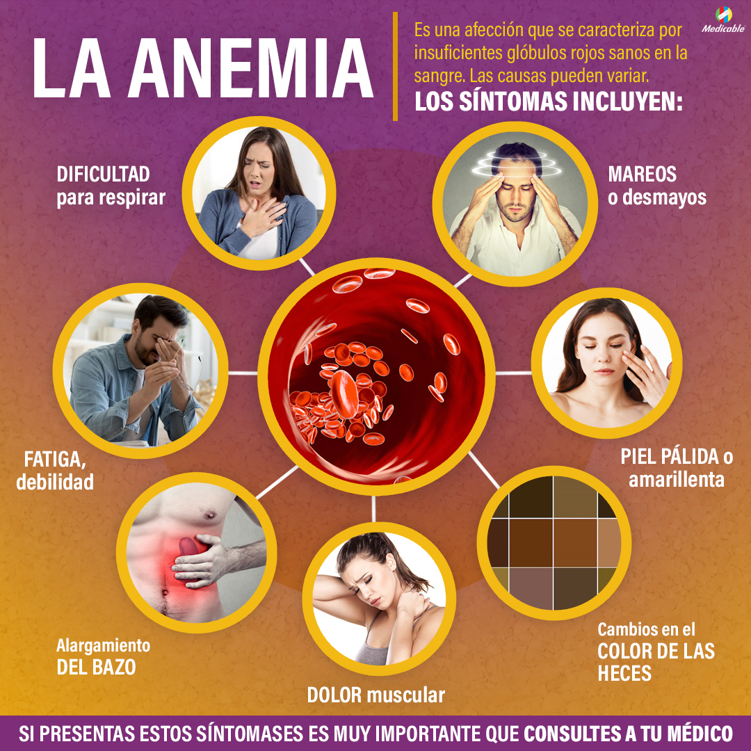 Síntomas de la anemia