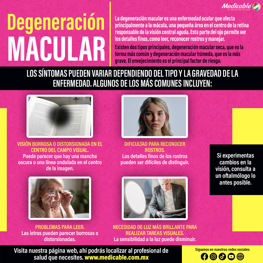 Degeneración Macular