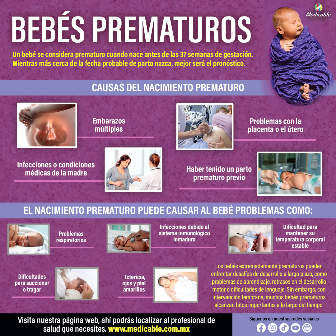 Bebés Prematuros