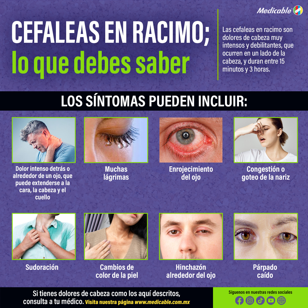 Cefaleas en racimo, lo que debes saber.