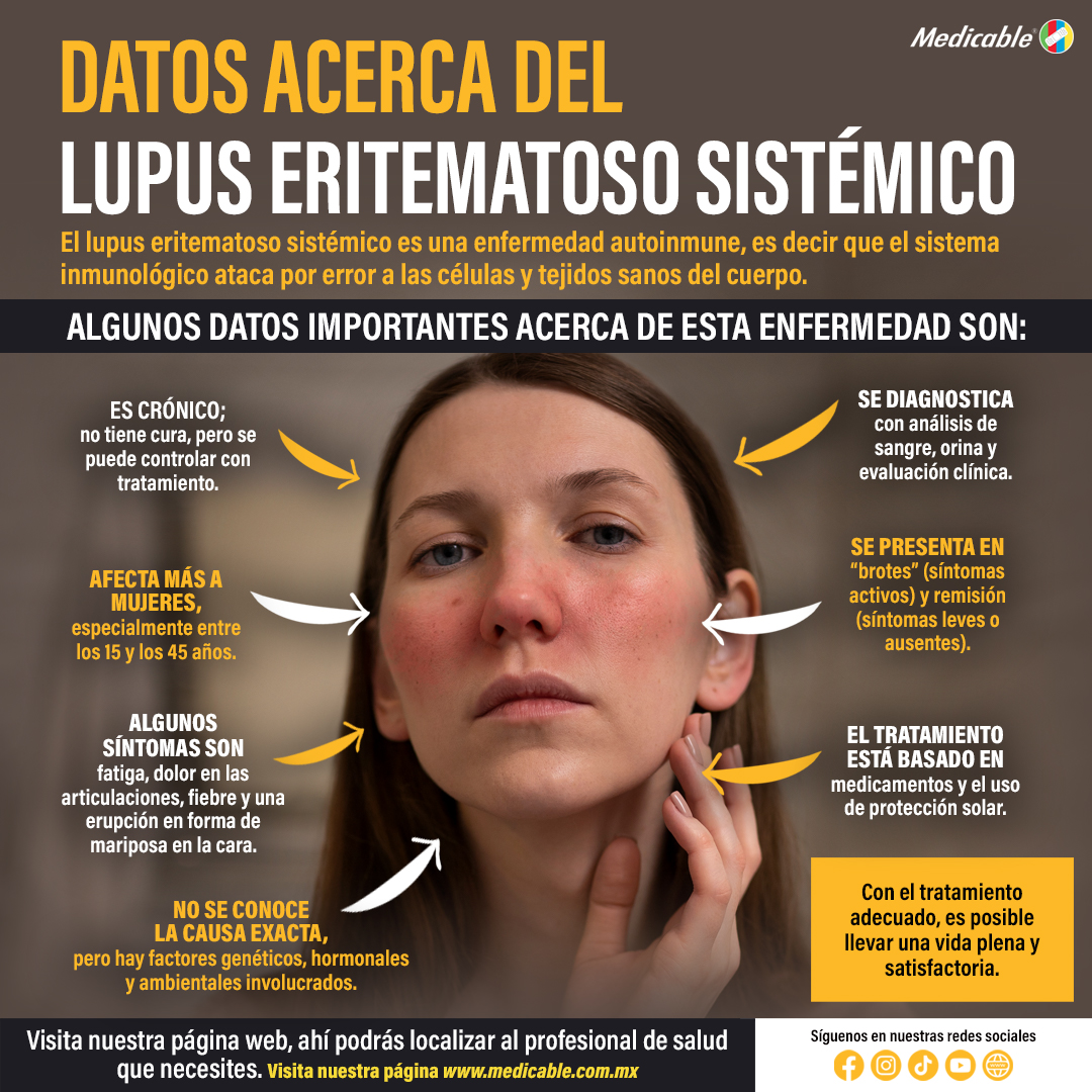 Datos acerca del Lupus Eritematoso Sistémico.