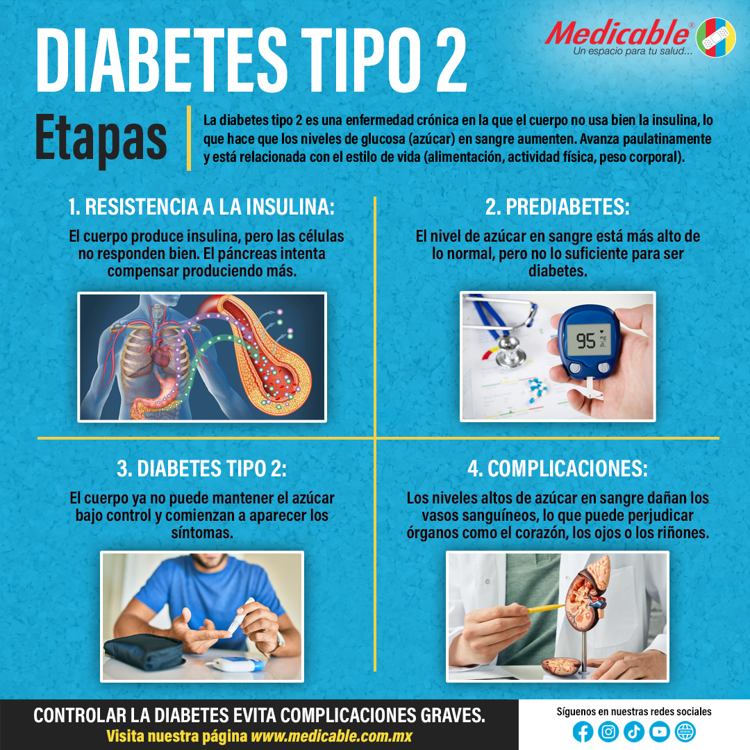Diabetes Tipo 2. Etapas