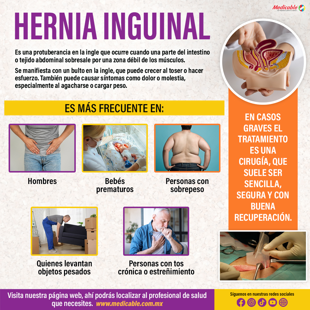 Hernia Inguinal.