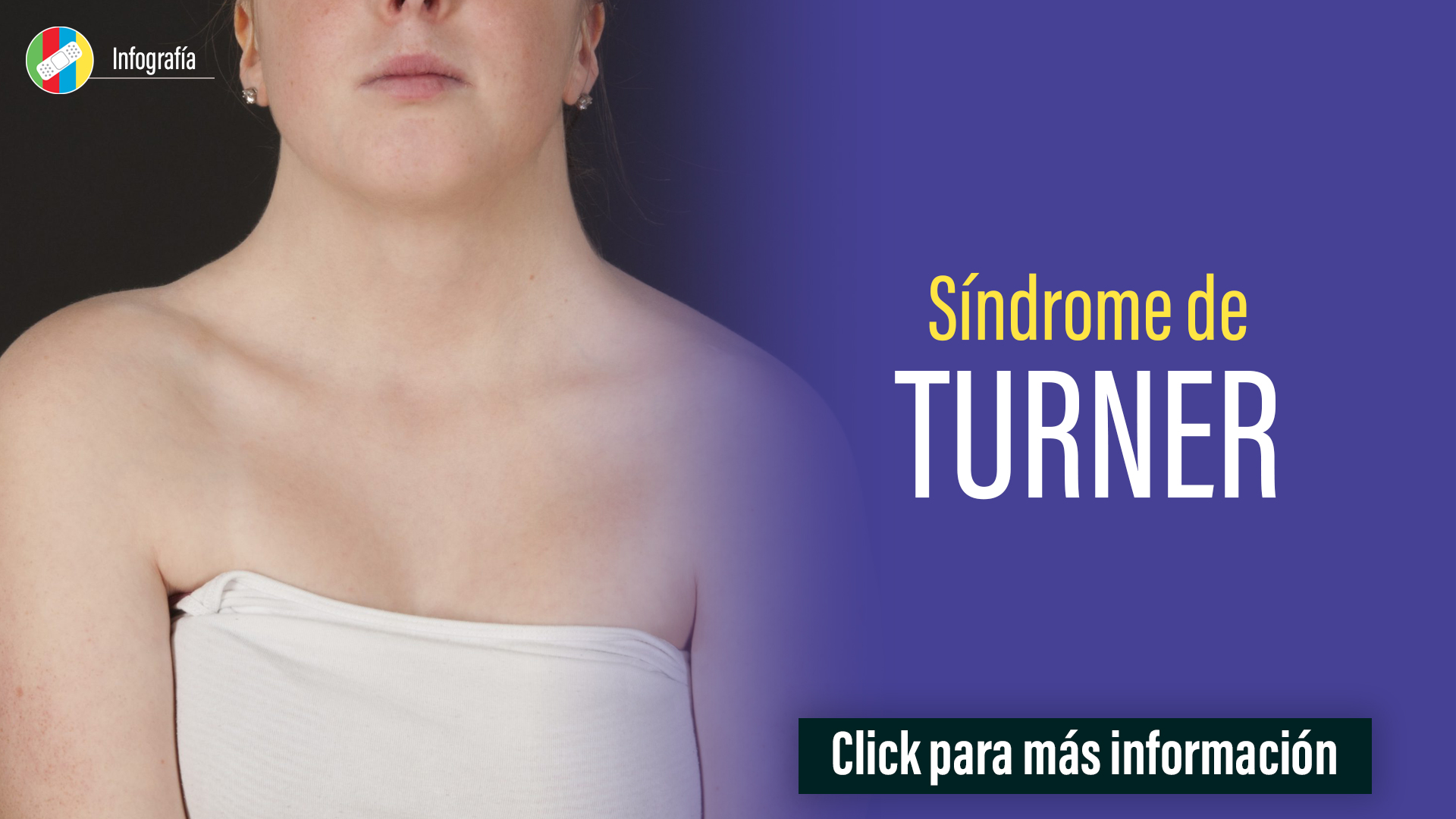 Síndrome de Turner