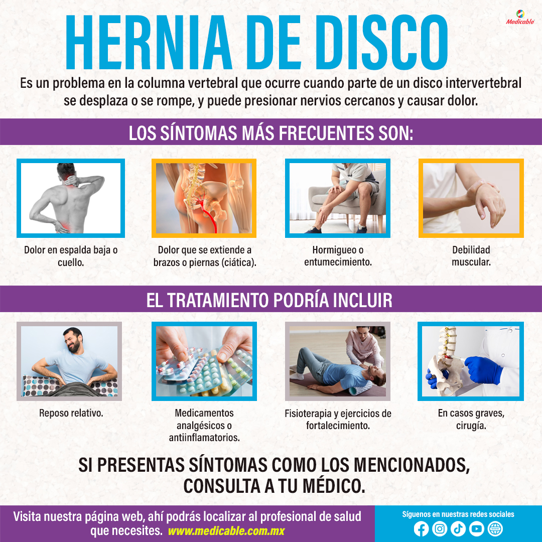 Hernia de disco.
