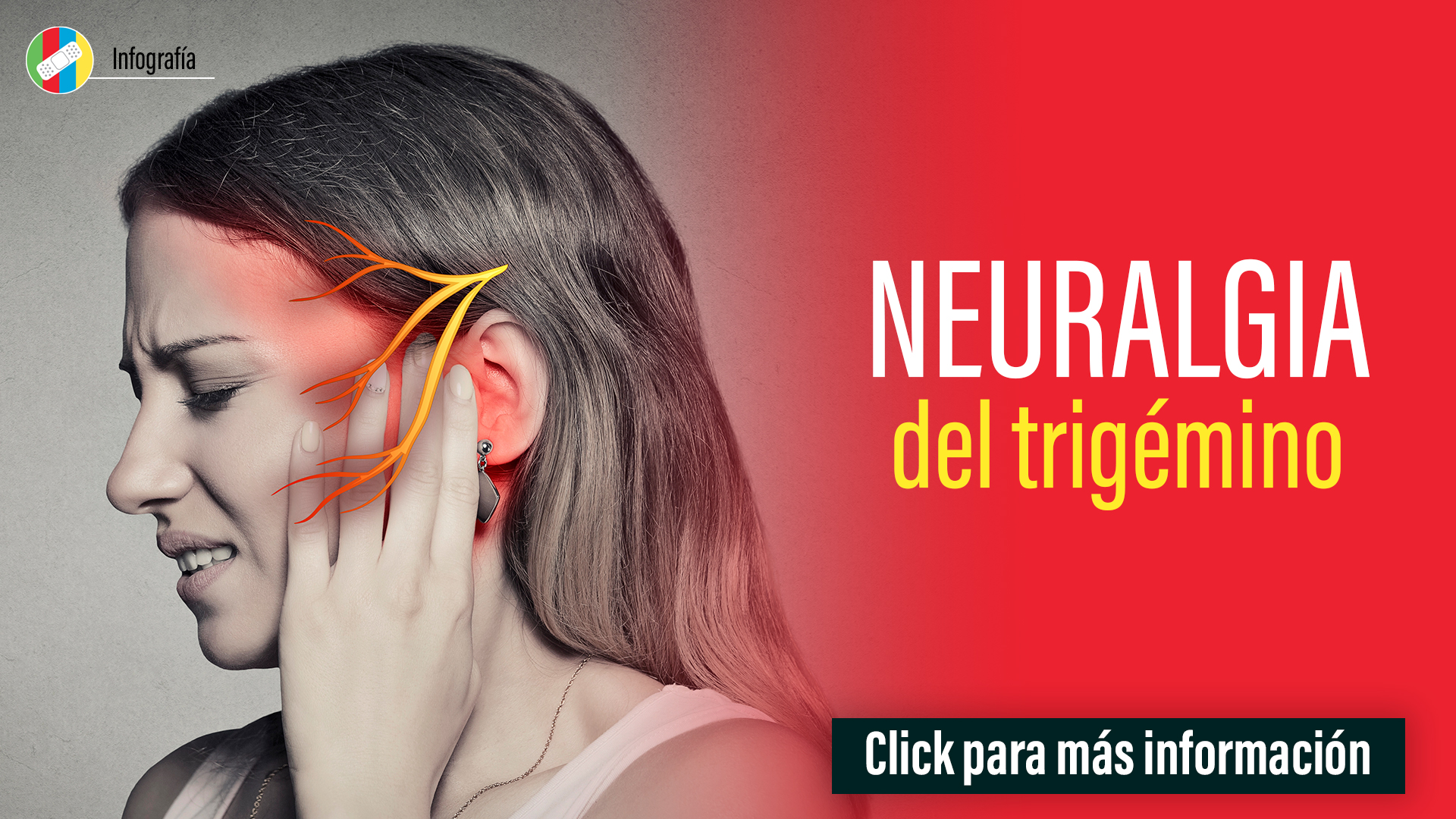 Neuralgia del trigémino.