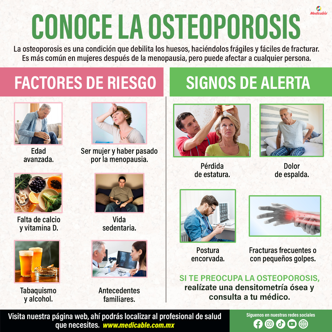 Conoce la Osteoporosis.
