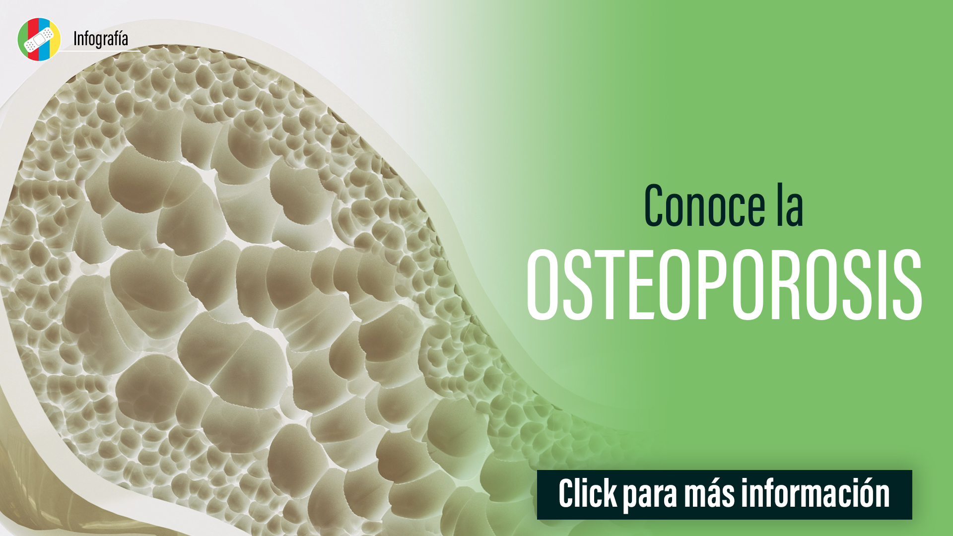 Conoce la Osteoporosis.