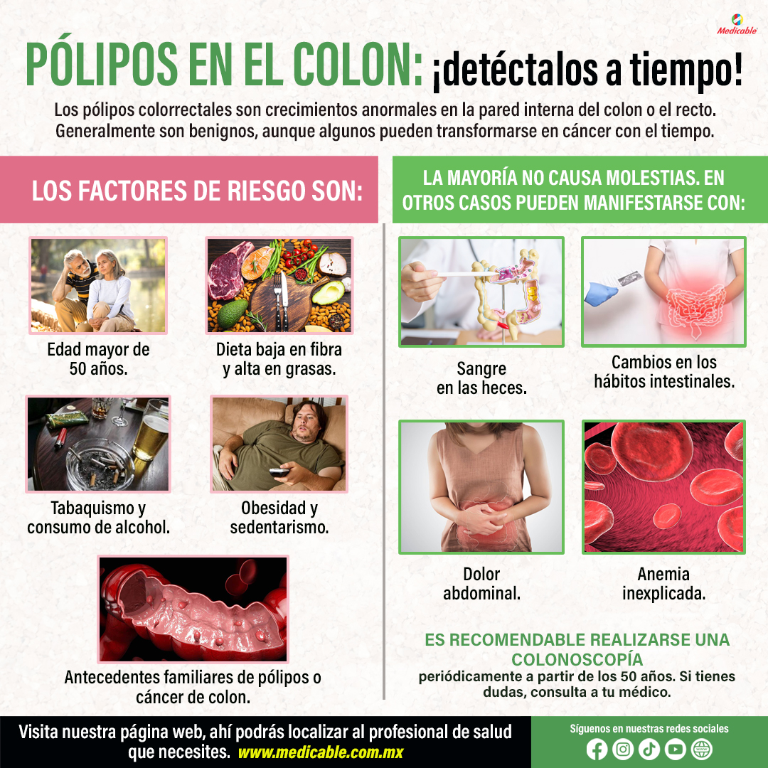 Pólipos en el Colon: ¡detéctalos a tiempo!
