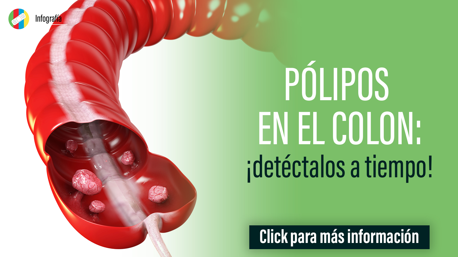 Pólipos en el Colon: ¡detéctalos a tiempo!