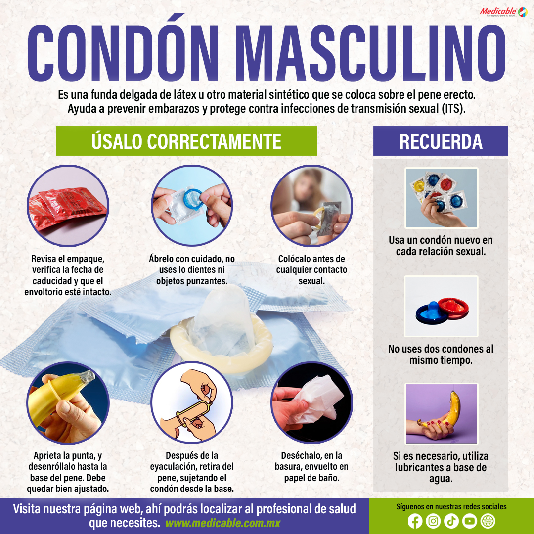 Condón masculino