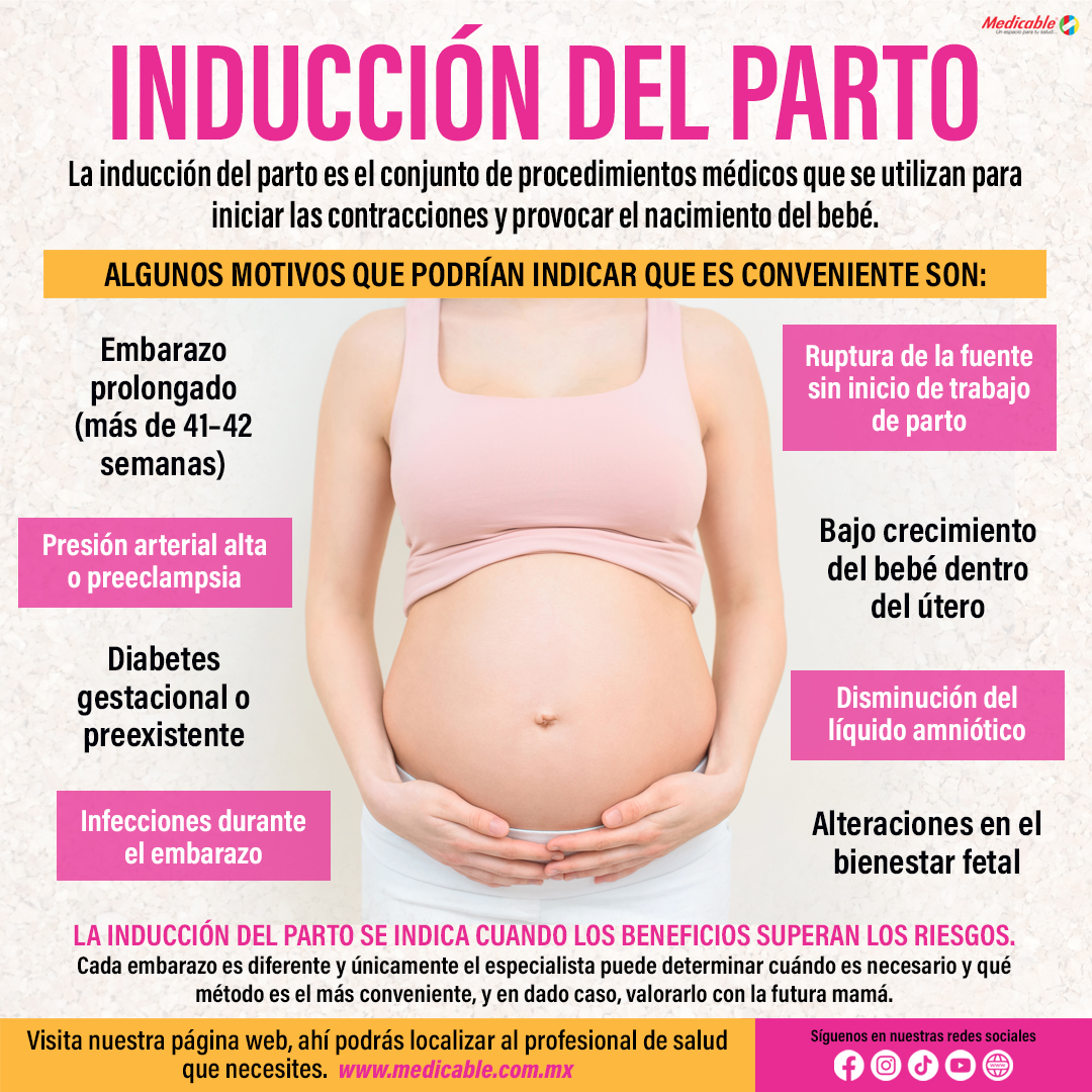 Inducción del parto