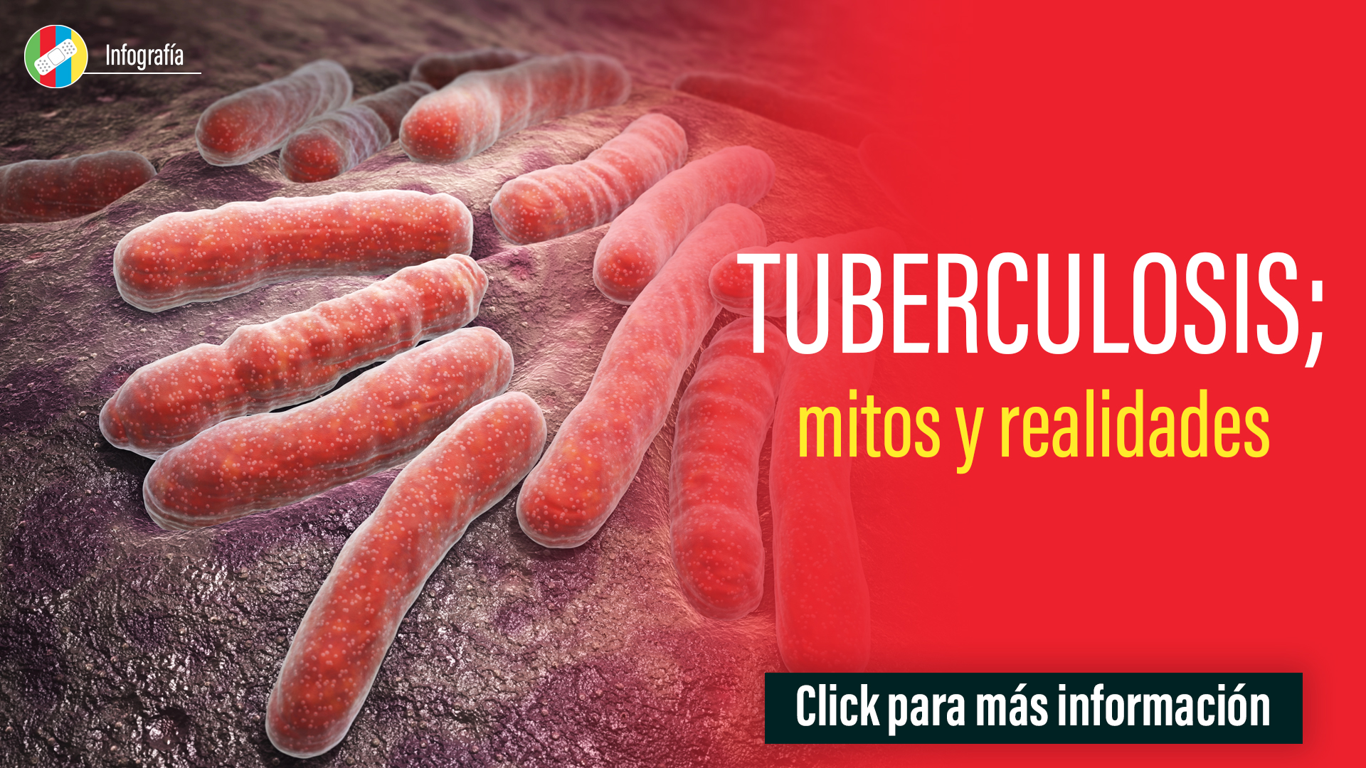 Tuberculosis
Mitos y realidades
