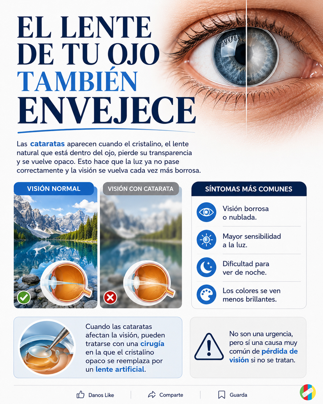 El lente de tu ojo también envejece